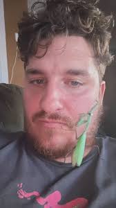 What's wrong with my Chinese mantis's eye?