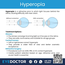 Image result for Refractive Error