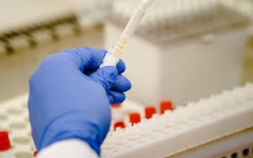 Pcr tests are a mandatory requirement for travel, when entering and leaving the uk. Een Gratis Pcr Test Voor Niet Gevaccineerde Reizigers Nederland Lijkt Dwars Te Liggen Leeuwarder Courant