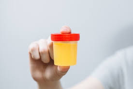 Melansir dari healthline, berikut beberapa jenis warna air mani yang menandai kondisi kesehatan tertentu, antara lain air mani sendiri terdiri dari berbagai mineral, protein, hormon, dan enzim yang semuanya. 7 Warna Sperma Dan Artinya Bagi Kesuburan Pria Ayah Sudah Tahu