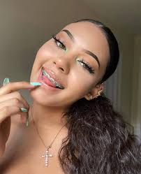 girls with braces are so pretty 🫶🏻🥺🎀>>