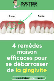 Pin On Remedes Naturels Contre Les Maladies