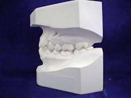 Rather than a mold that fits around your teeth, these bite pads cushion your back teeth at the point of clenching. Mouthguards Sportingsmiles Versus The Dentist Sportingsmiles