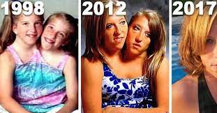 In the clip, the girls also explained how despite their shared torsos, they are often different temperatures. 13 Famous People Who Were Actually Spies And They Were Good At It Conjoined Twins Twins Marriage Humor