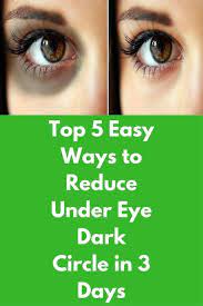 Top 5 Easy Ways To Reduce Under Eye Dark Circle In 3 Days Dark Discoloration Of Skin Under The Eyes Is Referred As Dark Dark Eye Circles Undereye Dark Circles