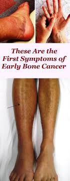 Pin On Health