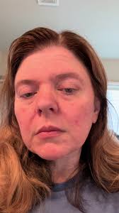 Mary Kay Eye Puffiness Reducer