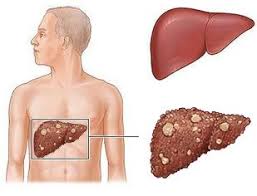 Pin On Manus Aktteva Biopharma Llp