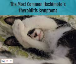 About 24 million (7%) people in the united states are affected by an autoimmune disease. The Most Common Hashimoto S Thyroiditis Symptoms Heyhashi