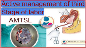 Image result for Active Management of Labor