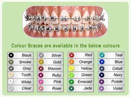 Braces Color Chart Teeth Braces Dental Braces Braces Tips