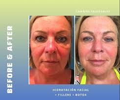 Nutrición & Estética