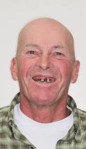 Dental Before & After Photos