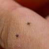Los síntomas más comunes de la sarna humana (que en inglés se conoce como scabies) incluyen tener una picazón ¿quieres hacerte el examen de sarna humana? Https Encrypted Tbn0 Gstatic Com Images Q Tbn And9gcsdvjfmytmll44z3uykmcpu7t7cwbacrpzq1fybi3q Usqp Cau