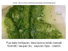 Check spelling or type a new query. Baru 94 Warna Feses Bayi Hijau