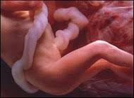 The month you are in is just an approximation. Pregnancy Day By Day All Days Of My Pregnancy