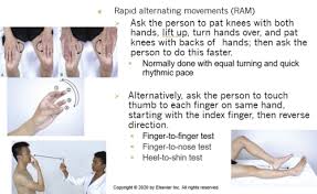 Image result for Rapid Alternating Movements