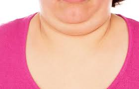 We did not find results for: 3 Cara Ampuh Menghilangkan Lemak Di Leher Double Chin Hello Sehat