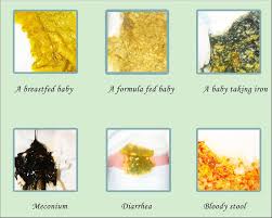 Jika warna berubah menjadi kuning muda atau bahkan menjadi kuning tua itu ertinya bahawa perubahan warna air kencing itu boleh dijadikan indikasi bahawa tubuh kita perlukan air. Warna Urine Bayi Warna Apa Yang Normal Atau Perlu Diwaspadai Theasianparent Indonesia