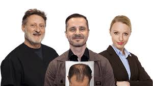 Garlic gel has been shown to aid hair loss caused by alopecia areata (image: Scalp Inflammation And Hair Loss Hairsite Com