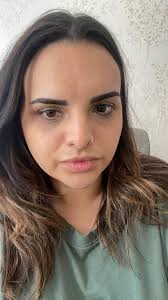 What are the best skin care tips for pregnant women?