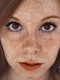 So charming freckles