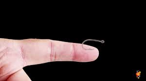Image result for Fishhook Removal