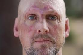 Celeb Chef Matt Golinksi's first interview is heart breaking