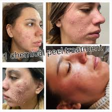 Tara Hinkle (@celestial_esthetics_skincare) · Lakewood, CO