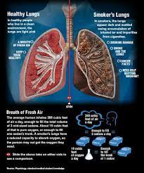 Pin On Lung Issues Pulmonary