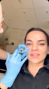 Mezoterapia igłowa okolicy oczu