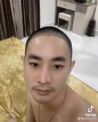 តោះតោះបងប្អូនទាំងអស់គ្នាដែលមានបញ្ហាសក់ជ្រូះ , និងសក់មិនដុះ, ឬមានបញ្ហាទំពែក  ឈប់ព្រួយបារម្ភទៀតទៅ ខាងគ្លីនិករបស់យើង អាចជួយបងប្អូនបាន ពីបញ្ហាសក់ទំពែក  សំរាប់បងប្អូនដែលមានចំណាប់អារម្មណ៍ចង់ដាំសក់ ...