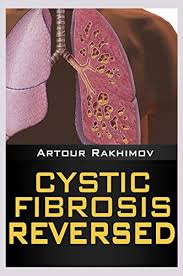 Pearce wilcox, md, cf clinic director, st. Cystic Fibrosis Life Expectancy 30 50 70 Health Fitness And Dieting Children S Health Cystic Fibrosis Book 1 English Edition Ebook Rakhimov Artour Amazon De Kindle Shop