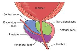 Image result for Acute Bacterial Prostatitis