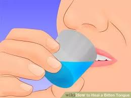 Heal A Bitten Tongue Healing Tongue Bitten