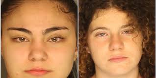 Clumps of hair' woman attacked while sitting in car in Red Lion