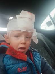Boy (3) 'scarred for life' after dog attack in Belfast