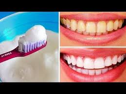 Ecco Qui 10 Modi Efficaci Per Sbiancare I Tuoi Denti In Modo Naturale Senza Rovinare Lo Con Immagini Sbiancare I Denti Sbiancamento Naturale Dei Denti Sbiancamento Dentale