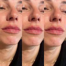 Alexandra Aesthetics Clinic