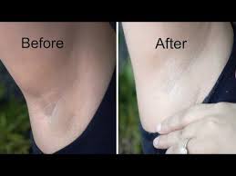 How can i naturally get rid of dark armpits? Pin On Skin