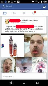 Think vapes do their damage over time? Graphic Photos Man S Face After A Recent Mechanical Mod Explosion Vapor Vanity