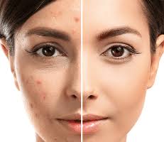 Mohs Surgery Specialist