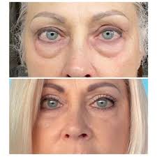 TOP 10 BEST Cosmetic Surgeons in Vicksburg, MS