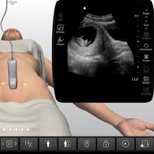 Image result for First Trimester Ultrasound