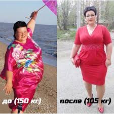 я похудела на 10 кг фото до и после Ot Chego U Poryadochnoj Zhenshiny Lishnij Ves Osteohondroz I Bezdenezhe Zdorove Zdorovyj Bystro Pohudet
