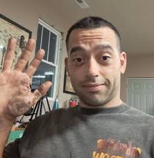 How much do tree climbers get paid per day?