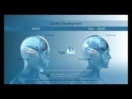 The neuroscience of the adhd brain. The Adhd Brain Youtube