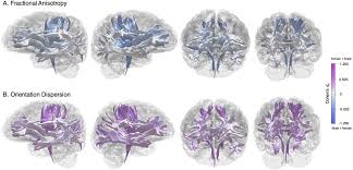 This step is usually taken only after the deepest introspection and counselling regarding all the options. Sex Differences In The Adult Human Brain Evidence From 5 216 Uk Biobank Participants Biorxiv