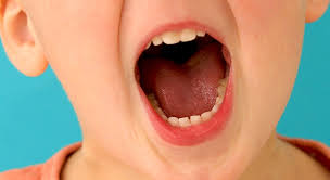How to stop tongue thrusting in toddlers. Orofacial Myology Miller Therapy Llc