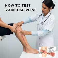 Image result for Venous Tap Test